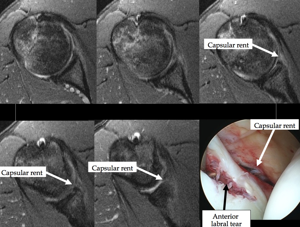 Figure 4 for case dislocation ( RID4770 )